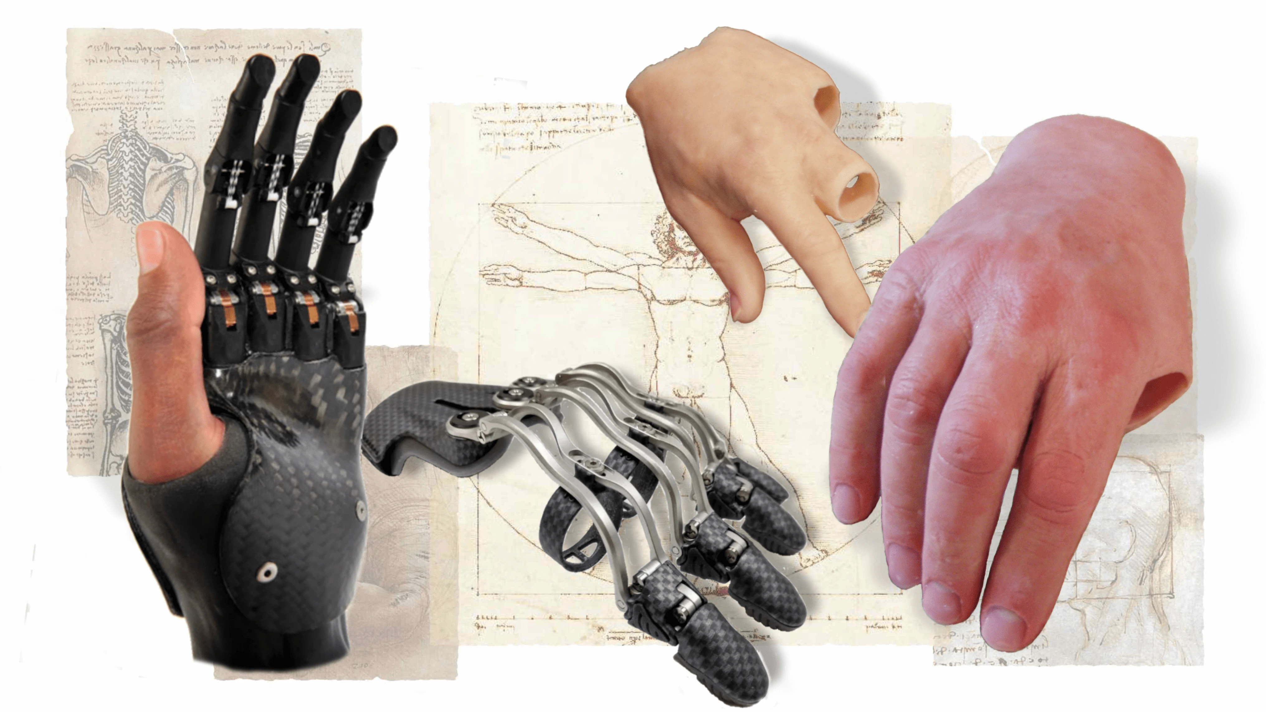 Custom silicone hands and electric fingers give partial hands options